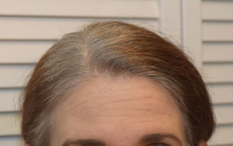 Gray roots - August 2016