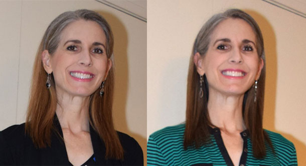 before and after toner